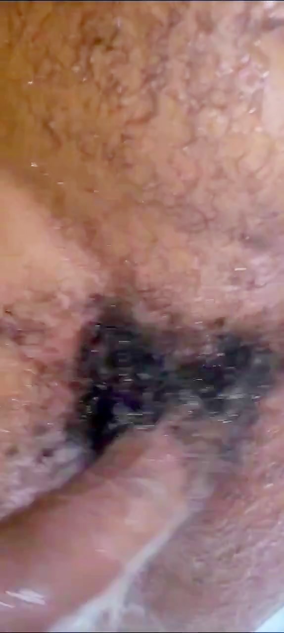 Thumb 19