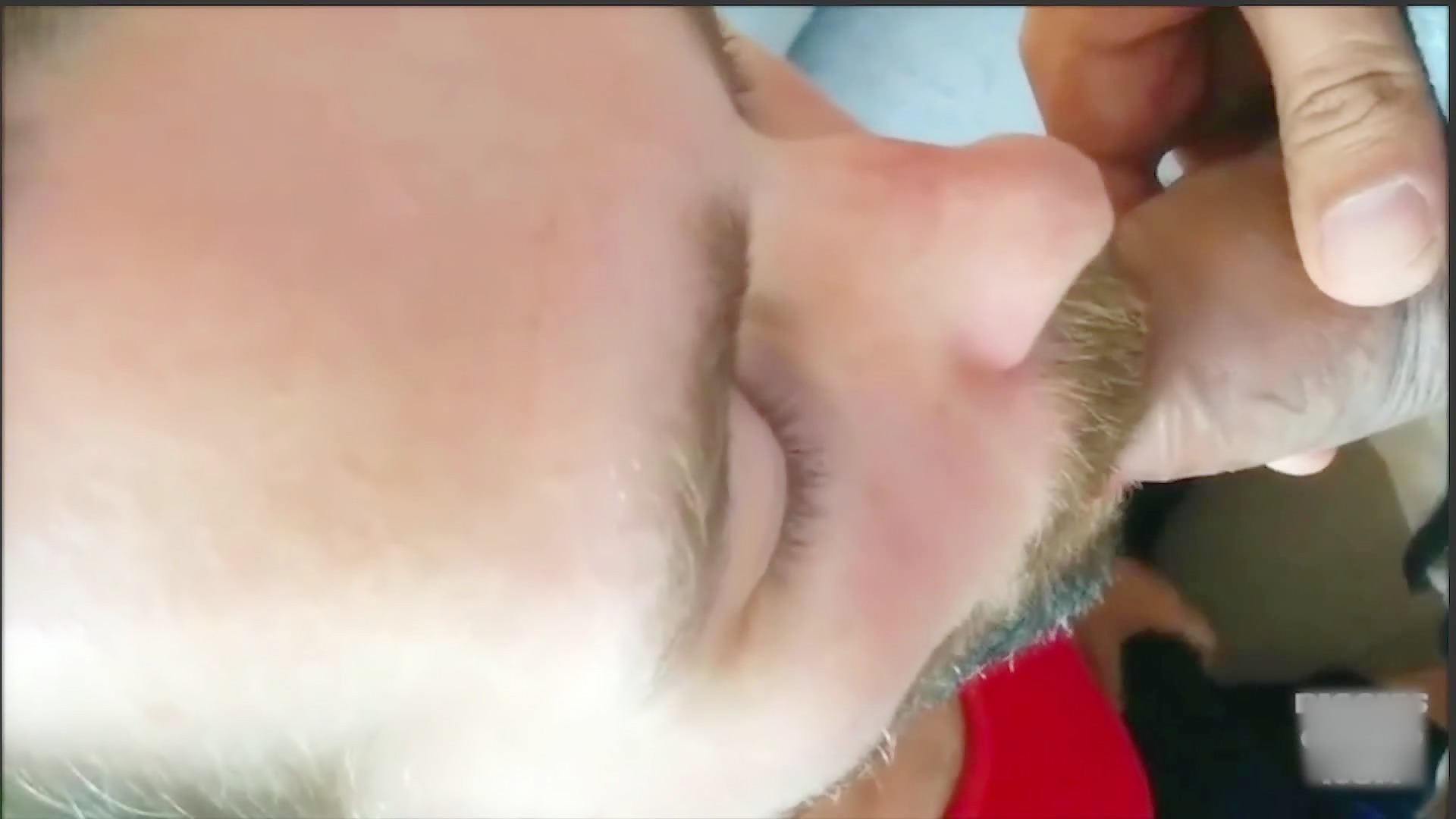 Thumb 17