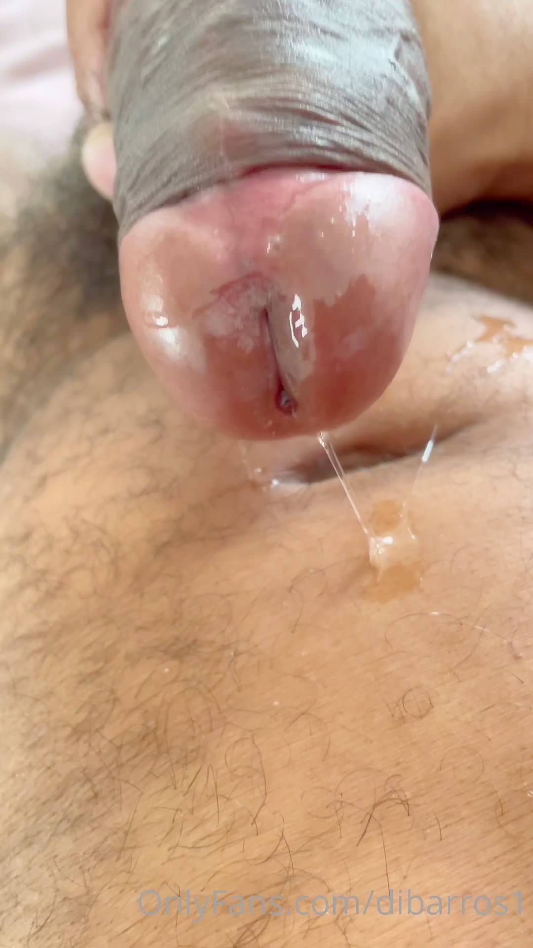 Thumb 20