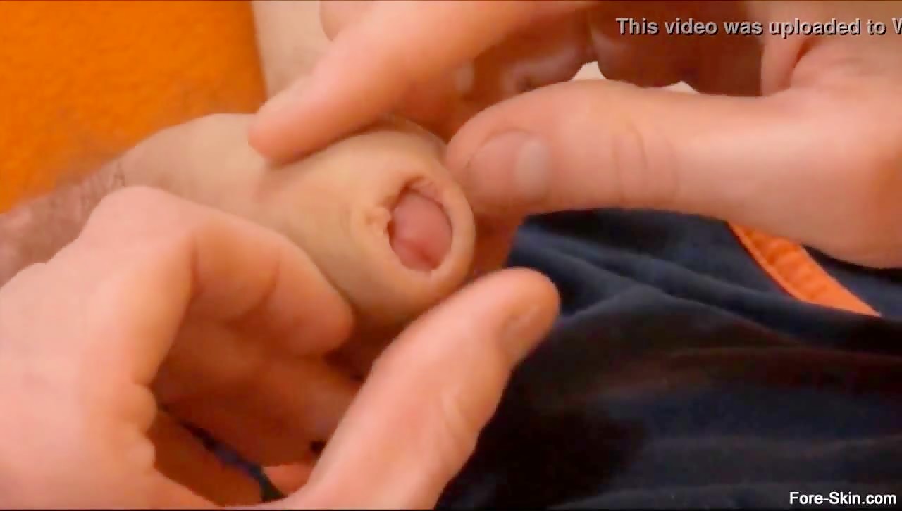 Thumb 7