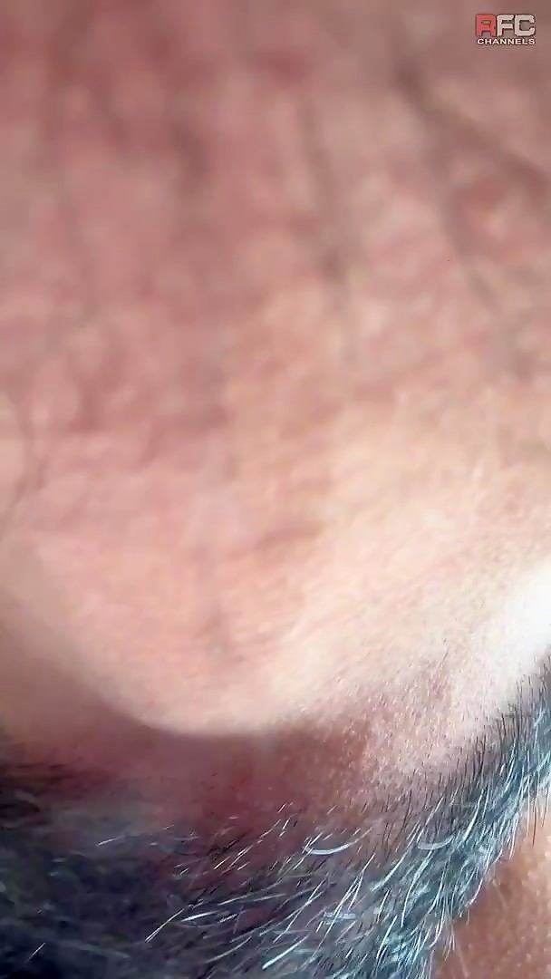Thumb 8