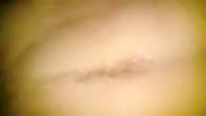 Thumb 20