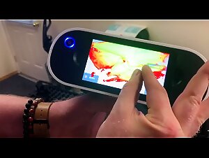 Thumb 6