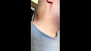 Thumb 10