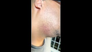 Thumb 9
