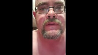 Thumb 9